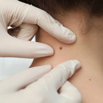Małgorzata Grabowska-Olejarczyk, Dermatolog Kielce - 