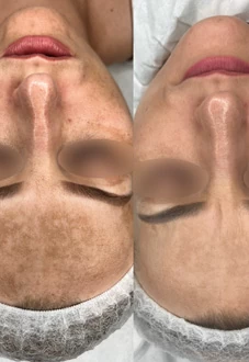 Małgorzata Grabowska-Olejarczyk, Dermatolog Kielce - 