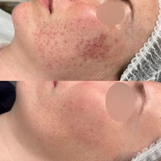 Małgorzata Grabowska-Olejarczyk, Dermatolog Kielce - 